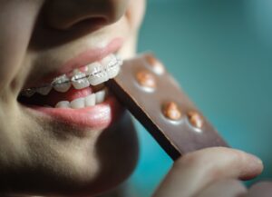 lakewood orthodontics